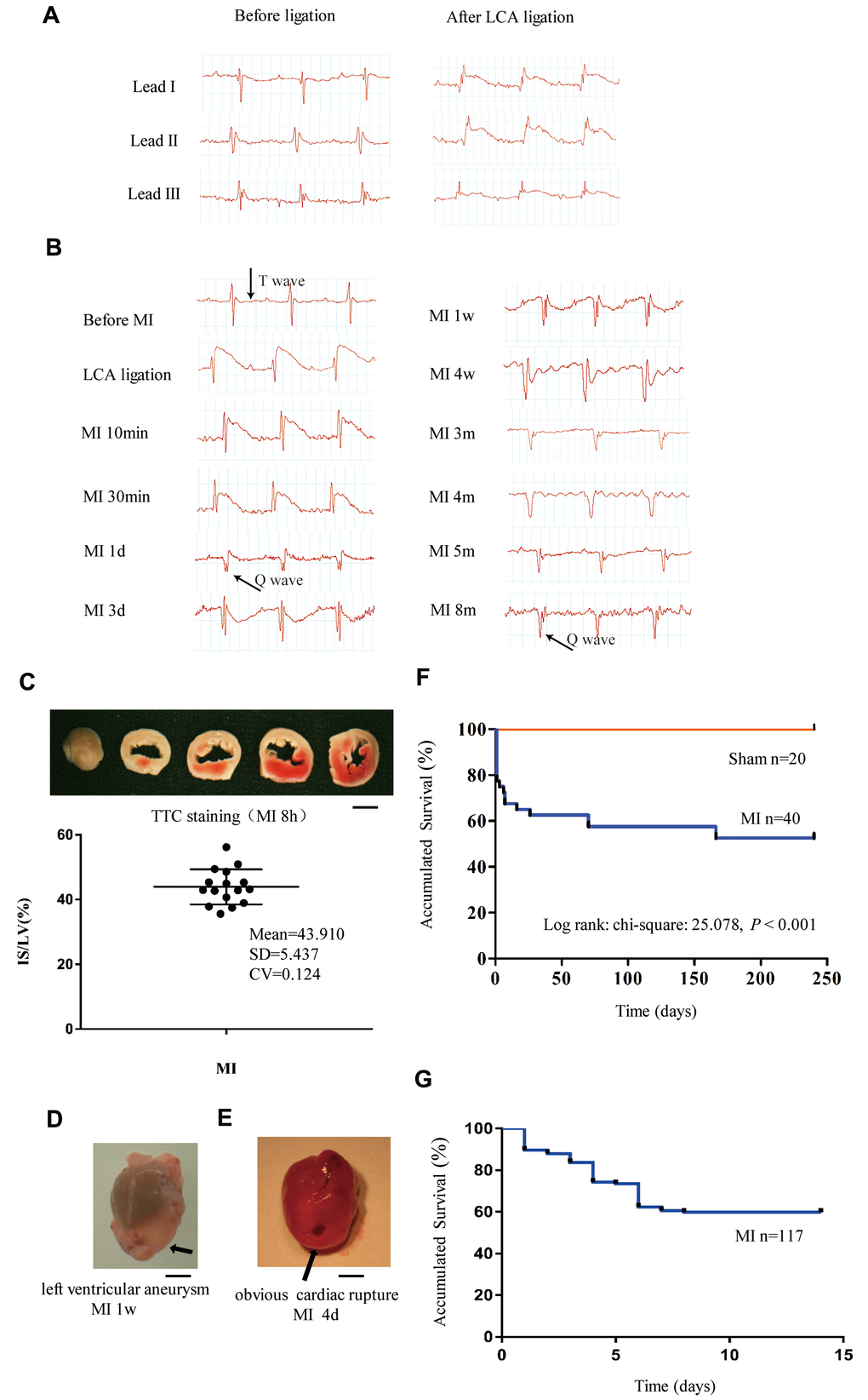 Monitoring of long-term MI mouse model for 8 months. (A) Limb leads I, II and III of electrocardiogram (ECG) reliably reflect the acute ischemia induced by left coronary ligation in C57BL/6 mice. (B) Lead II ECG can reflect different stages of myocardial infarction (MI) for a time period of 8 months. (C) Triphenyl tetrazolium chloride (TTC)-stained sections of heart in mice with MI for 8 h; the infarct size (IS)/ left ventricle (LV) was approximately 44% in the MI groups. (D) Representative left ventricular aneurysm formed 1 week after MI; (E) Example necropsy images of a dead mouse showing obvious rupture in the left ventricle free wall. (F): Kaplan–Meier survival analysis of mice subjected to MI or sham operation for 8 months. (G) Kaplan–Meier survival analysis of mice subjected to MI or sham operation for 14 days, n = 114 in MI group; Scale bar =2 mm for panel (C, D and E).