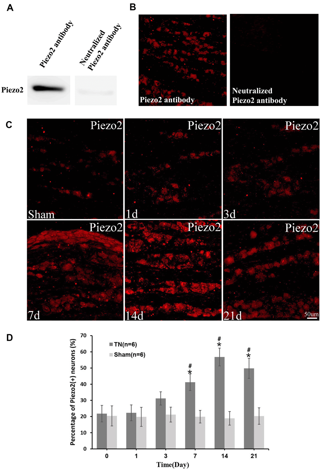 Immunocytochemistry of Piezo2. The efficiency of Piezo2 antibody was confirmed by Western blotting and immunofluorescence (A, B). Immunocytochemistry images show the expression of Piezo2 in sham group and TN group at different time points (C). With quantification, the percentage of Piezo2 positive neuron at different time points is displayed, which reaches peak at day 14 (9.2±1.6% in TN group vs. 2.21±1.1% in sham group, pD). *p