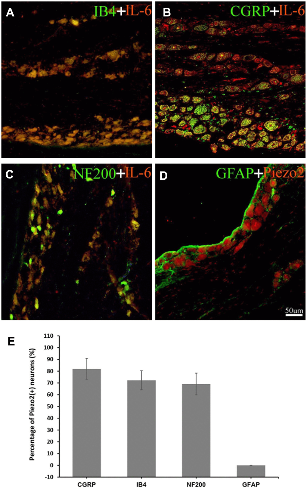Double immunofluorescence staining of IL-6. The double immunofluorescence staining shows IL-6 is co-localized with IB4 (a marker for C-type neurons) (A), CGRP (a marker for small nociceptive peptidergic neurons) (B) and NF-200 (a marker for A-type neurons) (C) but not with GFAP (a marker for satellite glial cells) (D). With calculation, the percentage of IL-6 in IB4, CGRP, NF200 neuron was 72.3±8.1%, 81.9±8.9%, 69.1±9.2% respectively (E). The red refers to IL-6, the green refers to IB4, CGRP, NF-200 or GFAP, and the yellow refers to the colocalization.