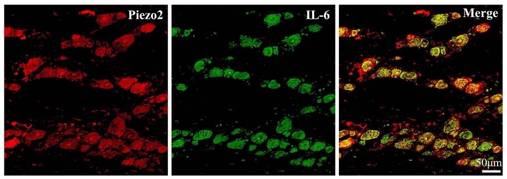Double immunofluorescence staining of IL-6 and Piezo2. The double immunofluorescence staining results exhibit the colocalization (yellow) of IL-6 (Green) and Piezo2 (Red).