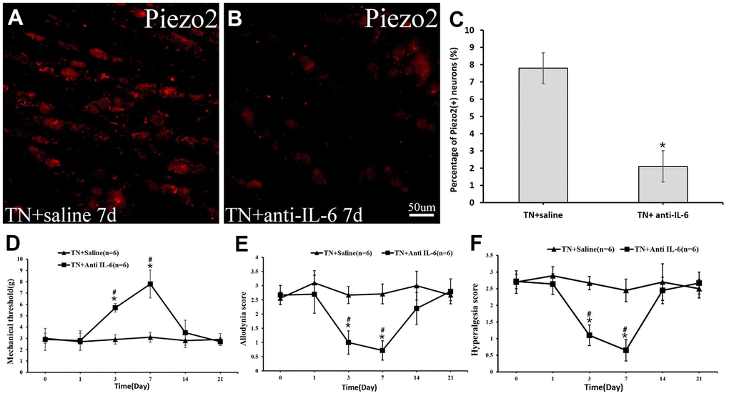 The Piezo2 expression after anti-IL-6 administration. Immunocytochemistry imaged show the expression of Pieao2 in TN+saline group (A) and TN+anti-IL-6 group (B) at day 7, which accounts for 41.2±9.8% vs. 15.1±6.2% (pC). Three days after intraperitoneally administration of the anti-IL-6 in those trigeminal model rats, significant changes in mechanical threshold (D) as well as dynamic allodynia (E) and pinprick hyperalgesia scores (F) are observed.