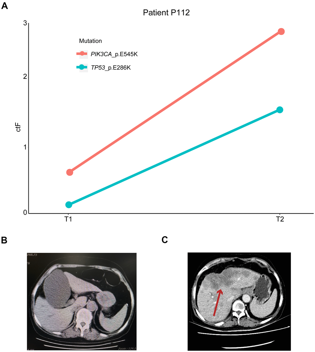 Mutation tracking in metastasis and recurrence patients. (A) ctDNA mutation tracking in patient P112. Computed tomography scan of P112 patient on (B) T1 and (C) T2 follow-ups. The red arrow indicates the patient’s metastatic foci. ctDNA, circulating tumor-derived DNA.