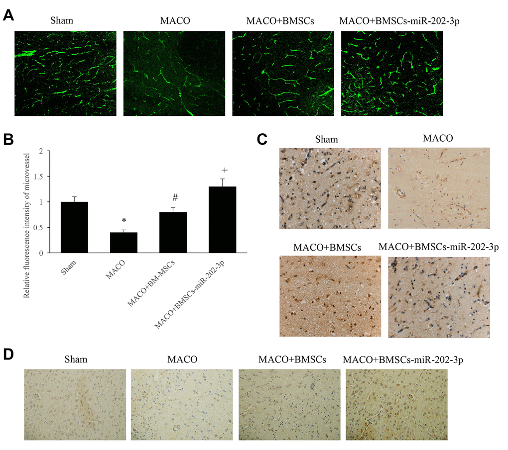 miR-202-3p can significantly promote angiogenesis. (A) Immunofluorescence detection of microvessels by injection of FITC-dextran (magnification: 200×). (B) Quantitative analysis of microvessels. (C) Immunohistochemical detection of vWF (magnification: 200×). (D) Immunohistochemical detection of VEGF (magnification: 200×). (*compared with sham, #compared with MCAO, +compared with MCAO + BMSCs, p