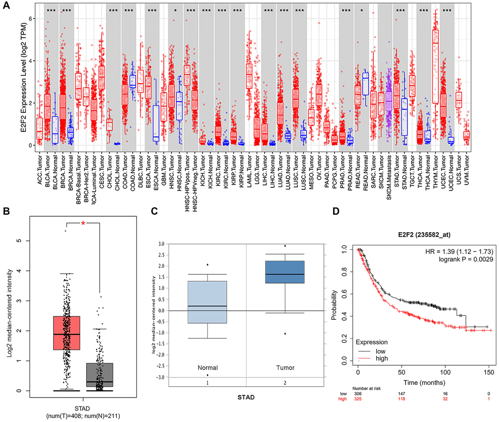 Expression and methylation of E2F2 in GC tissues and normal tissues as revealed by bioinformatic analysis. (A) E2F2 expression levels in different tumor types from the TCGA database were detected by TIMER (*P **P ***P B and C) E2F2 mRNA is highly expressed in LGG tissues in GEPIA (B) dataset and Oncomine (C) dataset. (D) Kaplan-Meier analysis of survival rates of GC patients with high E2F2 expression and GC patients with low E2F2 expression.