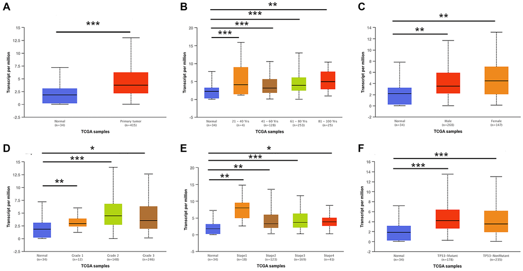 E2F2 mRNA expression in subgroups of patients with GC, stratified based on gender, age and other criteria (UALCAN). (A) Boxplot shows the relative expression of E2F2 in normal and STAD samples. (B) Boxplot shows the relative expression of E2F2 in normal individuals of any age and in STAD patients aged 21-40, 41-60, 61-80, or 81-100 years. (C) Boxplot shows the relative expression of E2F2 in normal individuals of either gender and in male or female STAD patients. (D) Boxplot shows the relative expression of E2F2 in normal individuals and in STAD patients with stage 1, 2, 3 or 4 disease. (E) Boxplot shows the relative expression of E2F2 in normal individuals and in STAD patients with grade 1, 2, 3 or 4 tumors. (F) Boxplot shows the relative expression of E2F2 based on TP53 mutation status. The central mark is the median; the edges of the box are the 25th and 75th percentiles. A t-test was used to estimate the significance of differences in gene expression levels between groups. *P **P ***P 