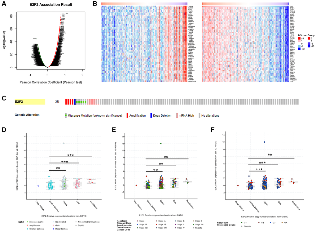 Genes co-expressed with E2F2 (LinkedOmics) and genomic alterations (cBioPortal) in GC. (A) The global genes highly correlated with E2F2 were identified by Pearson test in the STAD cohort. (B) Heat maps show the top 50 genes that were positively and negatively correlated with E2F2 in STAD. Red indicates positively correlated genes and blue indicates negatively correlated genes. (C) OncoPrint of E2F2 alterations in the STAD cohort. The different types of genetic alterations are highlighted in different colors. (D) E2F2 expression in different E2F2 CNV groups. (E and F) Distribution of E2F2 CNV frequency in different stage and grade subgroups. *P **P ***P 