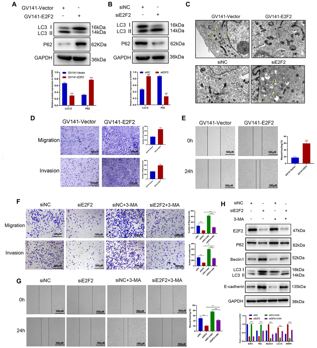 Effects of E2F2 expression levels on GC cell migration and invasion via autophagy mediation. (A) Western blotting analysis of P62 and LC3-II protein expression in GC cells transfected with GV141-Vector or GV141-E2F2. β-actin was used as a loading control. (B) Western blotting analysis of P62 and LC3-II protein expression in GC cells transfected with siNC or siE2F2. β-actin was used as a loading control. (C) Representative electron micrographs of autophagic vesicles in GC cells transfected with GV141-Vector or GV141-E2F2 and in GC cells transfected with siNC or siE2F2. (D) GC cells were transfected with GV141-Vector or GV141-E2F2 for 24 h. Comparison of GC cell migration and invasion using Transwell compartments. (E) A wound-healing assay was performed to compare the motility of GC cells. The wound-healing area was analyzed using ImageJ software. (F) GC cells were transfected with siNC and siE2F2 or treated with phosphate-buffered saline (control), 3-methyladenine (2 mM) or a combination of both treatments for 24 h. Comparison of GC cell migration and invasion using Transwell compartments. (G) Wound-healing assay was performed to compare the motility of GC cells. (H) Western blotting analysis of P62, Beclin1, LC3-II and MMP9 protein expression. β-actin was used as a loading control. Data are presented as the mean ± S.D. from three independent experiments. *P **P ***P 