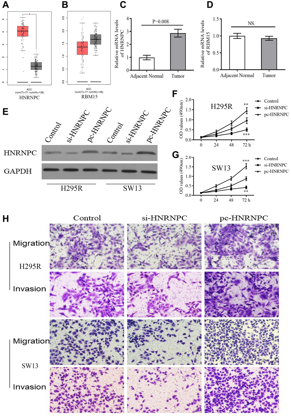 The expression and biofunction of HNRNPC in ACC. (A–B) The differential expression of HNRNPC and RBM15 between tumor and normal samples based on GEPIA database. (C–D) The differential expression of HNRNPC and RBM15 in 5 pairs of clinical specimens. (E) Detection of transfection efficiency. (F–G) HNRNPC can promote proliferation of H295R and SW13 cells. (H) HNRNPC can promote migration and invasion of H295R and SW13 cells. *P 