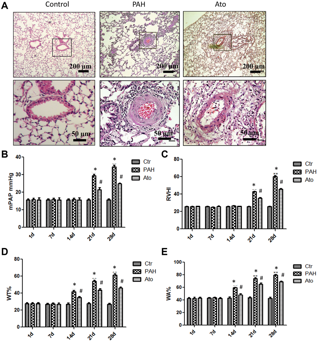 Ato improved the lung function of PAH rats. (A) Pathological changes of lung tissues after treatment with MCT and Ato; (B) mPAP of rats in different groups was measured at different time points; (C) RVHI of rats in different groups was measured at different time points; (D) WT was measured at different time points after treatment with MCT and Ato; (E) WA was measured at different time points after treatment with MCT and Ato. (*P