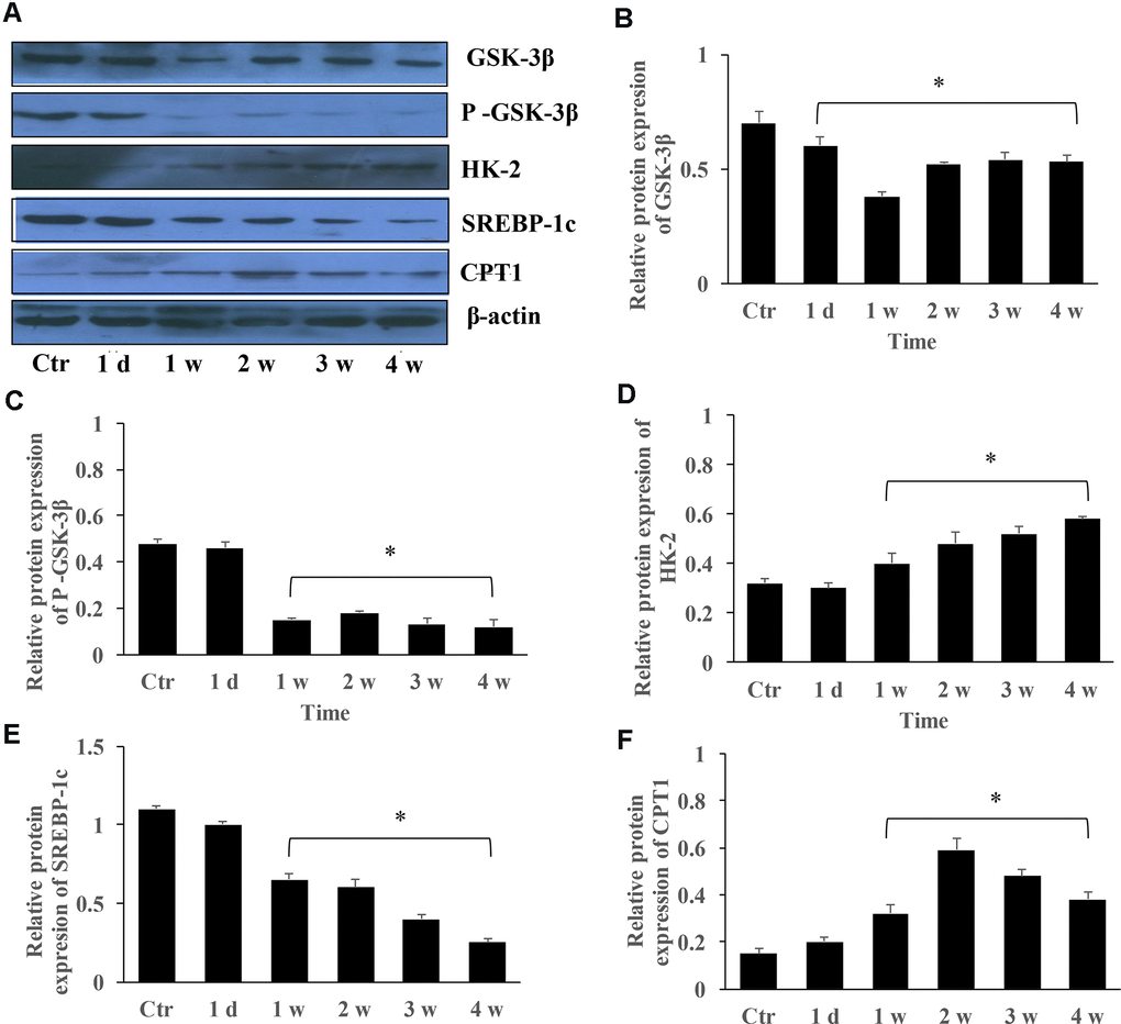 The protein expression changes of GSK-3β, HK-2, SREBP-1c, and CPT-1 in the group PAH. (A) The protein levels in the lung tissues of PAH rats was measured using western blotting; (B) The protein expression change of GSK-3β was quantified; (C) The protein expression of p-GSK-3β was quantified; (D) The protein expression of HK-2 in the lung tissues was quantified; (E) The protein expression of SREBP-1c was quantified; (F) The protein expression of CPT-1 was quantified. (*P