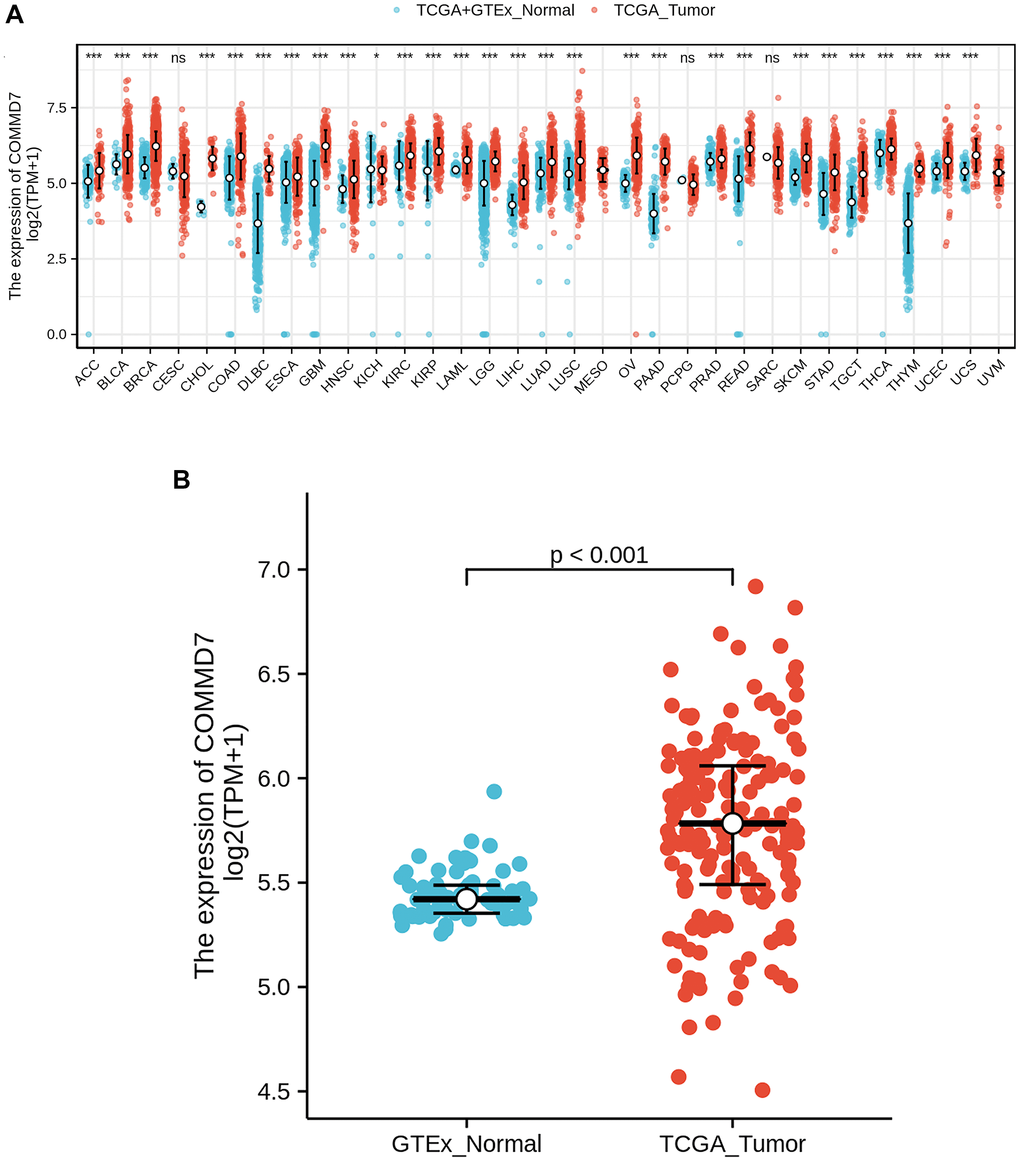 The higher expression of COMMD7 was showed in AML compared with normal samples. (A) Expression level of COMMD7 in paired normal and pan-cancer samples. (B) Expression level of COMMD7 in paired normal and AML samples. Analysis between two groups: Wilcoxon Rank sum test; NS: P 0.05 or higher; *P **P ***P 