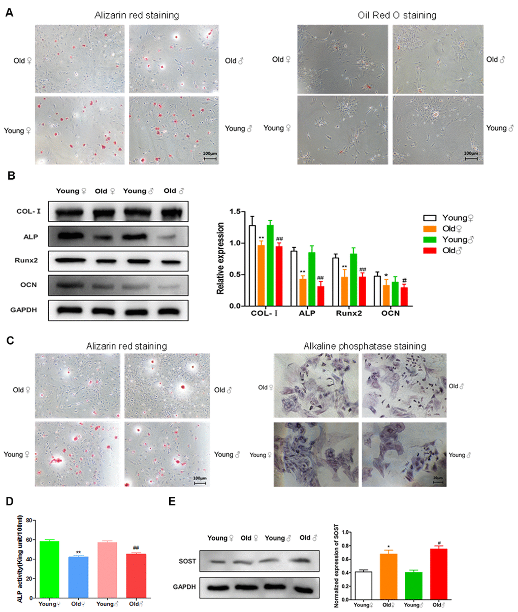 Functional activities of BMSCs, osteoblasts and osteocytes in aged rats compared to young rats. (A) Comparison of osteogenic and adipogenic differentiation ability of BMSCs between aged rats and young rats. BMSCs were cultured in osteogenic induction medium for 21 days, and alizarin red staining was performed. BMSCs were stained with oil red O after 14 days of culture in adipogenic induction medium, and the red drops in the figure were lipid droplets; (B) Determination of bone formation protein and statistics of protein relative expression in osteoblasts of aged rats and young rats (x¯±s,n=3); (C) Alizarin red staining and alkaline phosphatase staining of osteoblasts from aged rats and young rats; (D) The activity of alkaline phosphatase (ALP) in osteoblasts from old rats and young rats was measured (x¯±s,n=6); (E) The determination of sclerosteosis and the statistics of relative protein expression in osteocytes from old rats and young rats (x¯±s,n=3); *P #P ##P 