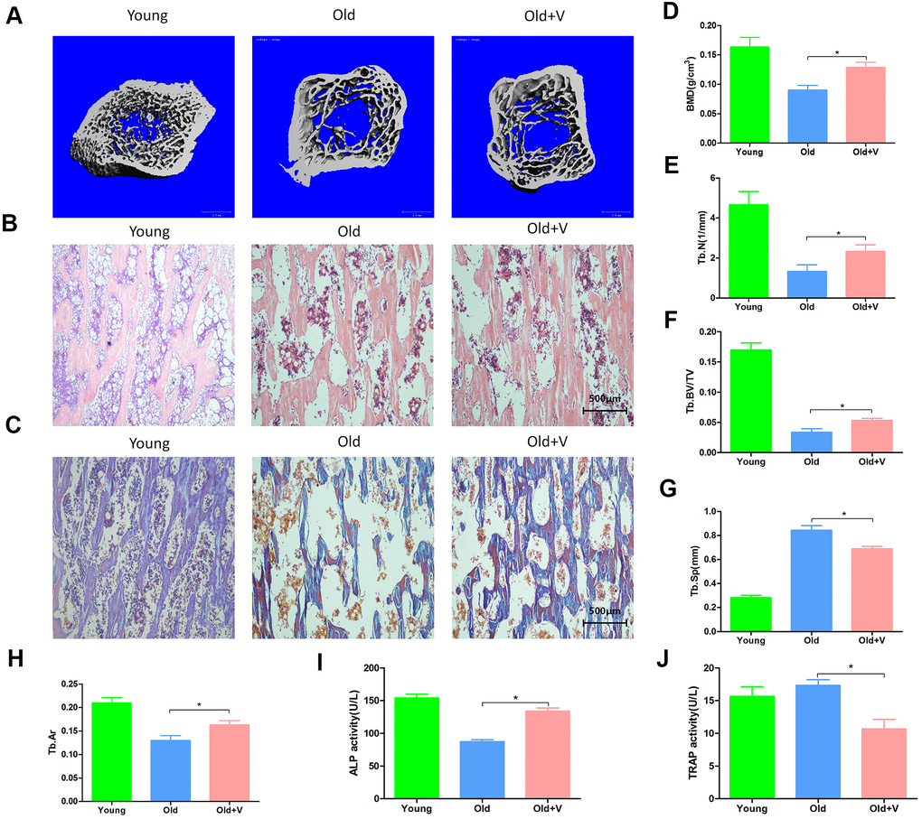 LMV promoted bone formation of aged rats. (A) uCT of femurs from rats treated with LMV; (B) HE staining of femurs from rats treated with LMV; (C) Masson staining of femurs from rats treated with LMV; (D–G) Morphometric parameters of femurs obtained by uCT analysis, including BMD, Tb. BV/TV, Tb. N, Tb. Sp (x¯±s,n=6); (H) Tb. Ar obtained by bone histomorphometric staining analysis (x¯±s,n=6); (I, J) Serum ALP activity and TRAP activity detection. *P 