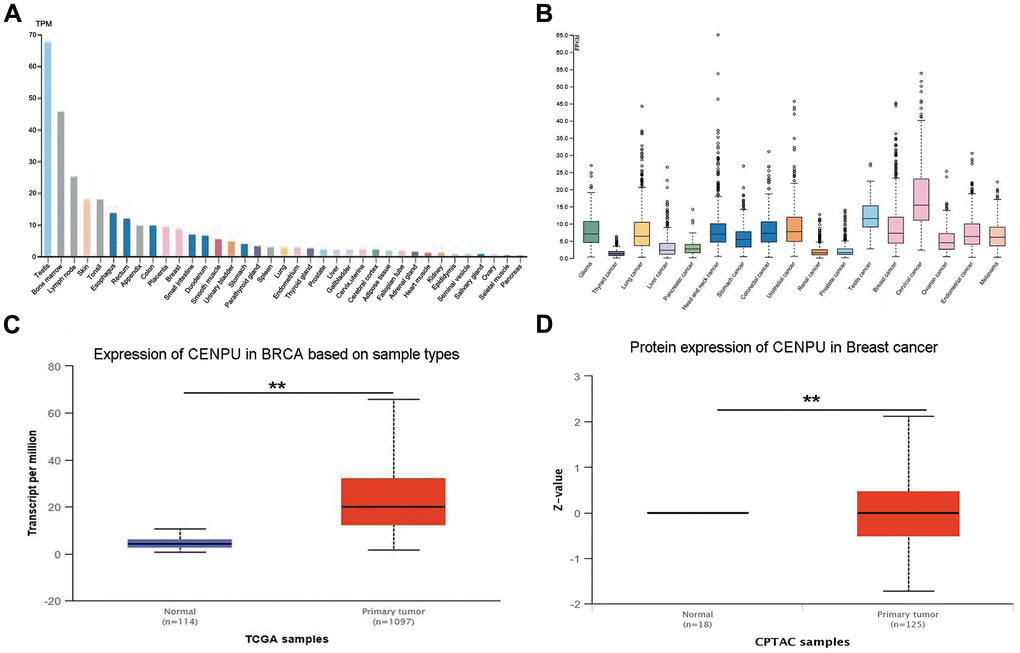 CENPU expression in normal and cancerous tissues. (A) CENPU mRNA expression in different normal tissues from the HPA database. (B) CENPU mRNA expression in different cancer tissues from the HPA database. (C–D) The mRNA and protein level expression of CENPU in breast cancer compared with normal tissue by analyzing UALCAN database, **P 