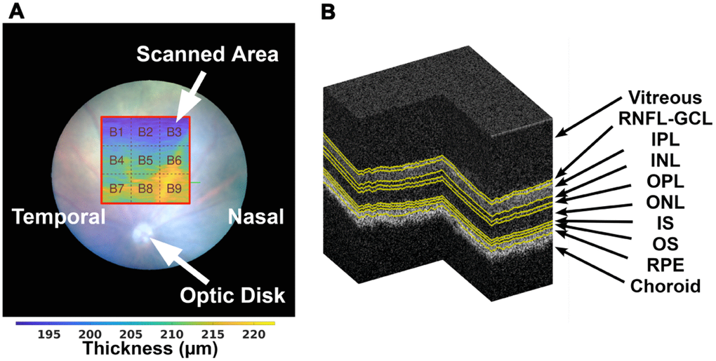 On the left (A), the illustration of the scanned area (with red border) with relation to the position of the optic disc, and division of the thickness maps into 3×3 blocks as addressed in section 2.5, over a TRT thickness map from a WT mouse at the age of one-month-old. A segmented OCT volume is shown on the right (B), where the various interfaces are presented in yellow.