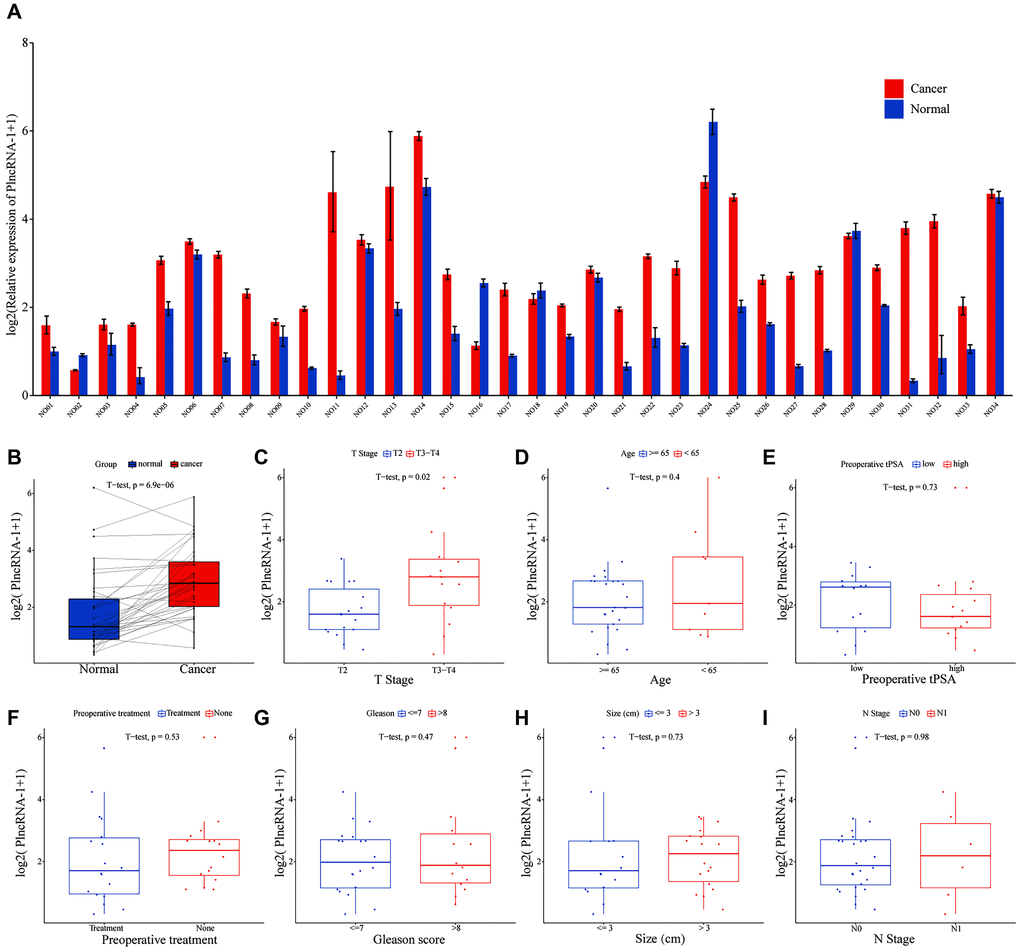 The level of PlncRNA-1 expression in PCa tissues. (A–B) The expression level of PlncRNA-1 in 34 pairs of PCa and normal matched tissues. (C–I) The correlation between the expression level of PlncRNA-1 and T stage, age, preoperative tPSA, preoperative treatment, Gleason score, tumor size, and N stage.