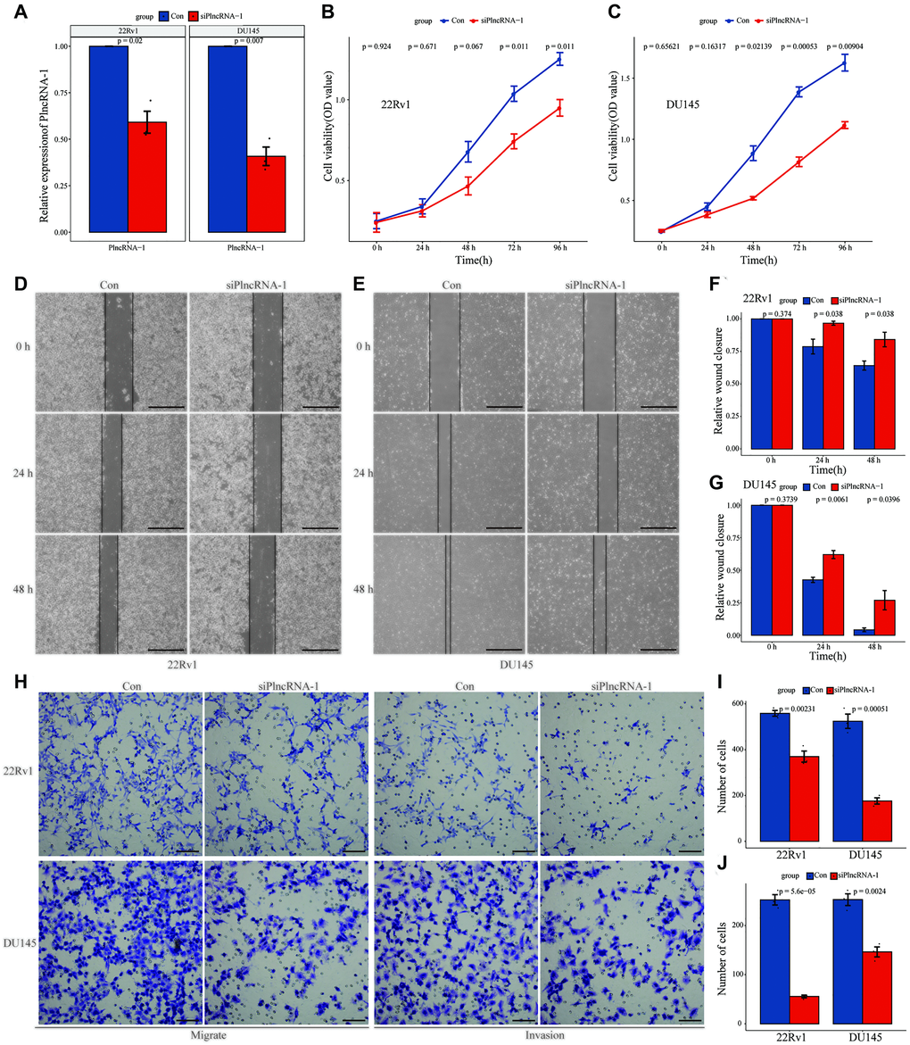 Effect of PlncRNA-1 knockdown on the proliferation, migration, and invasion of PCa cells. (A) qPCR analysis for the transfection efficiency of PlncRNA-1-siRNA in 22Rv1 and DU145 PCa cells. (B–C) CCK-8 assay for the proliferation of 22Rv1 and DU145 PCa cells after PlncRNA-1 silencing. (D–G) Wound healing assays for the migration of 22Rv1 and DU145 PCa cells after PlncRNA-1 silencing (Scale bar, 200 μm). (H) Transwell migration and invasion assays for the migration and invasion of 22Rv1 and DU145 PCa cells after PlncRNA-1 silencing (Scale bar, 100 μm). (I–J) Quantitative analysis transwell migration (I) and invasion (J) assays of 22Rv1 and DU145 PCa cells after PlncRNA-1 silencing.