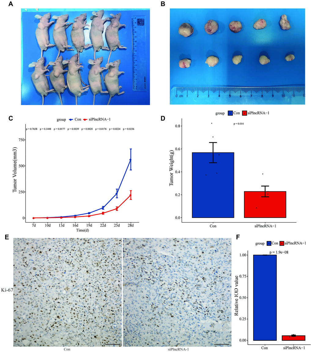 Xenograft tumor formation of DU145 cells in PlncRNA-1-silenced nude mice. (A) Photograph of nude mice with Xenografted tumors on day 28. (B) Pictorials of subcutaneous tumors on day 28. (C) Growth curves for xenografted tumors. (D) The tumor weights in different groups. (E) Immunohistochemistry assay for the expression of Ki-67 in the tumor xenografts (Scale bar, 100 μm). (F) Quantitative analysis immunohistochemistry assay for the expression of Ki-67 in the tumor xenografts.