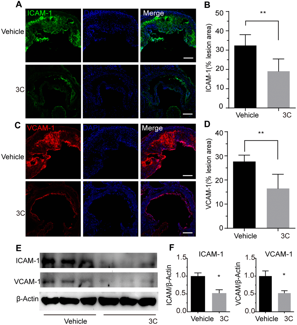 Treatment of ApoE-/- mice with 3C inhibits vascular inflammation. (A) Representative images of immunofluorescence staining for ICAM-1 as an indicator of the vascular inflammation from the aortic root of ApoE-/- mice treated with vehicle or 3C. (B) Quantification of ICAM-1 positive areas in plaques (n=6 per group). (C) Representative images of immunofluorescence staining for VCAM-1 form the aortic root of ApoE-/- mice treated with vehicle or 3C. (D) Quantification of VCAM-1 positive areas in plaques (n=6 per group). (E) Protein expression level of ICAM-1 and VCAM-1 protein in the aorta were assessed by Western blot analysis. (F) Quantitative results for the relative expression level of ICAM-1 and VCAM-1 normalized to β-Actin (n=3 per group). All data were assessed using Student’s t-test and are present as mean±SEM. *P **P