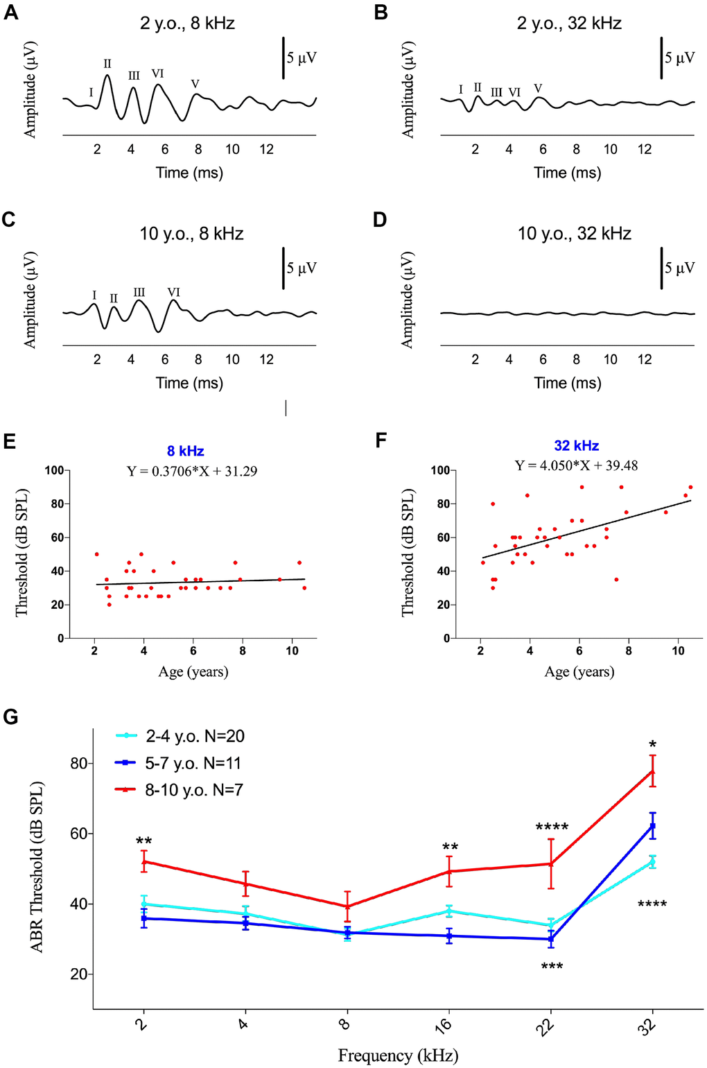 Effects of age on ABR thresholds in marmosets. (A–D) Examples of ABR waveforms of common marmosets aged 2 and 10 years following 80 dB SPL tone bursts at frequencies of 8 and 32 kHz. (E, F) Scatter plots and corresponding regression lines and regression equations for the relationships between ABR thresholds (dB SPL) of 36 individual marmosets and age (years) at frequencies of tone burst stimuli of 8 kHz (E) R-squared linear=0.01168, P=0.5304) and 32 kHz (F) R-squared linear=0.3172, P=0.0003). (G) Relationships between ages and auditory thresholds determined by ABR. Data are presented as mean ± SEM. **P 