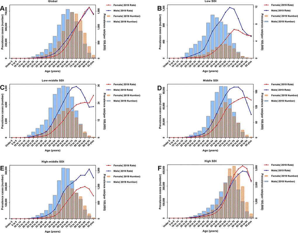 2019 absolute number of prevalent cases and prevalence rates per 100,000 persons of CAVD by sex and age in (A) the globe; (B) low SDI quintiles; (C) low-middle SDI quintiles; (D) middle SDI quintiles; (E) high-middle SDI quintiles; and (F) high SDI quintiles. Abbreviations: CAVD, calcific aortic valve disease; SDI: socio-demographic index.