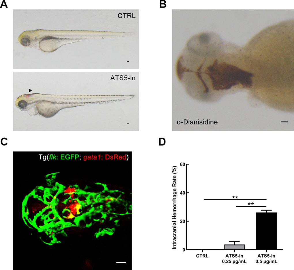 Inhibition of ADAMTS-5 causes intracranial hemorrhage in zebrafish. (A) Zebrafish embryos treated with DMSO (control, CTRL group), and intracranial hemorrhage in embryos treated with 0.5 μg/mL of ADAMTS-5 inhibitor (ATS5-in). The black arrow indicates the bleeding site. (B) O-Dianisidine staining confirming intracranial hemorrhage at 72 hpf. (C) Confocal microscopy showing cerebral blood vessel leakage of the Tg (flk: EGFP; gata1: DsRed) embryo. (D) Incidence rates of intracranial hemorrhage of the control group (CTRL) and ADAMTS-5 inhibitor treatment group (ATS5-in) at 0.25 μg/mL and 0.5 μg/mL. Scale bar: 50 μm. **P