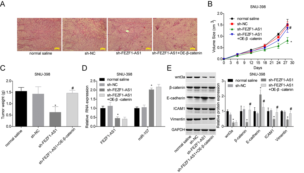 Downregulation of FEZF1-AS1 inhibited the tumor growth in vivo by targeting miR-107/Wnt/β-catenin axis. SNU-398 cells were divided into four groups, normal saline group, sh-NC group, sh–FEZF1-AS1 group, and sh–FEZF1-AS1 + OE-β-catenin group. (A) HE staining was used to analyze of histopathological changes of mice tumor tissues. (B, C) The tumor volume and weight were detected after the mice were euthanized. (D) qRT-PCR was used to detect the expression of FEZF1-AS1 and miR-107 in mice tumor tissues. (E) Western blot was used to test the expression levels of wnt3a, β-catenin, E-cadherin, ICAM1 and Vimentin in mice tumor tissues. *P #P 