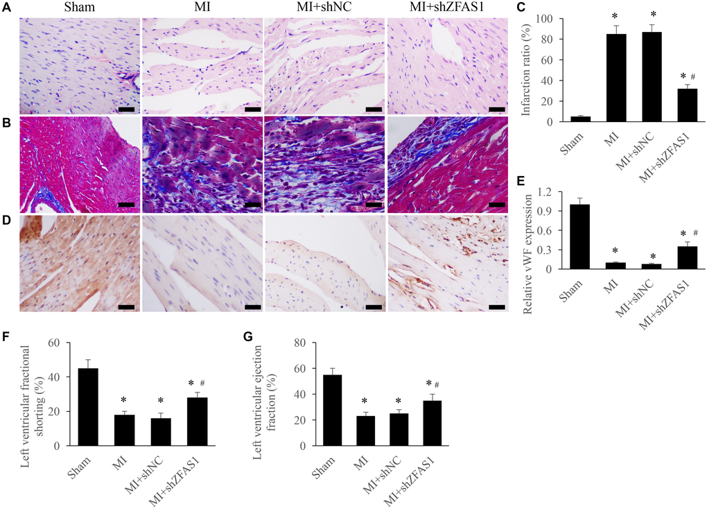 Improvement of cardiac function by silencing ZFAS1 in the MI rats. (A) Influence of shZFAS1 on the histological changes of MI rats myocardial tissues (Scale bar = 500 μm). (B) Influence of shZFAS1 on the collagen deposition of MI rats myocardial tissues (Scale bar = 500 μm). (C) Influence of shZFAS1 on the infarction ratio of MI rats myocardial tissues. (D) The expression of vWF in the MI rats myocardial tissues was measured using IHC staining (Scale bar = 500 μm). (E) Influence of shZFAS1 on the vWF expression in the MI rats myocardial tissues. (F) Influence of shZFAS1 on the left ventricular fractional shortening of MI rats. (G) Influence of shZFAS1 on the left ventricular ejection fraction of MI rats. *P #P 