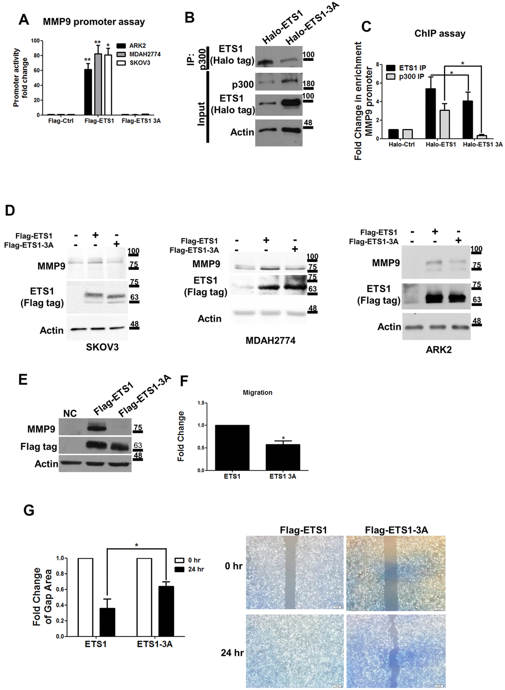 Mutant ETS1 is unable to activate MMP-9 expression. (A) MMP-9 promoter luciferase assays were co-transfected with the MMP-9 promoter construct using Flag-control, Flag-ETS1 or Flag-ETS1-3A in ARK2 (black box), MDAH2774 (gray box), and SKOV3 (white box) cells 48 h later. The MMP-9 promoter activity in transfected Flag-control cells was set as 1. Results are means ± standard errors of the mean from three independent experiments. (B) An anti-p300 antibody was able to precipitate Halo-ETS1 or Halo-ETS1-3A in overexpressing 293 cells. Halo-ETS1 or Halo-ETS1-3A in association with p300 was identified with an anti-Halo tag antibody. (C) ChIP assays were analyzed with Halo-ETS1, Halo-ETS1-3A, and endogenous p300 on the MMP-9 promoter in overexpressing 293 cells. Chromatin DNA was crosslinked with Halo-ETS1 or Halo-ETS1-3A and subsequently purified with a Halo-tag resin. Associated p300 was precipitated with an anti-p300 antibody. Enrichment of the MMP-9 promoter was identified by qPCR. Results are means ± standard errors of the mean from three independent experiments. (D) MMP-9 protein levels were increased by Halo-ETS1 or Halo-ETS1-3A in SKOV3, MDAH2774 and ARK2 cells. (E) MMP-9 expression was detected in 293 cells stably transfected Flag-ETS1. (F) The results of the transwell migration assay revealed that the migration ability of cells expressing wild-type ETS1 was higher than that of cells expressing ETS1-3A. Quantification of cell migration ability was performed by direct counting. (G) In wound closure assay, the cell-free gap area was quantified with the image J software (left panel). Cells characterized by higher migration ability produced smaller cell-free gap areas. Cell-free gap areas at 0 and 24 h are shown as open and black bars, respectively. Results in (F, G) are means ± standard errors of the mean from three independent experiments. Asterisks denote statistical significance (*p 