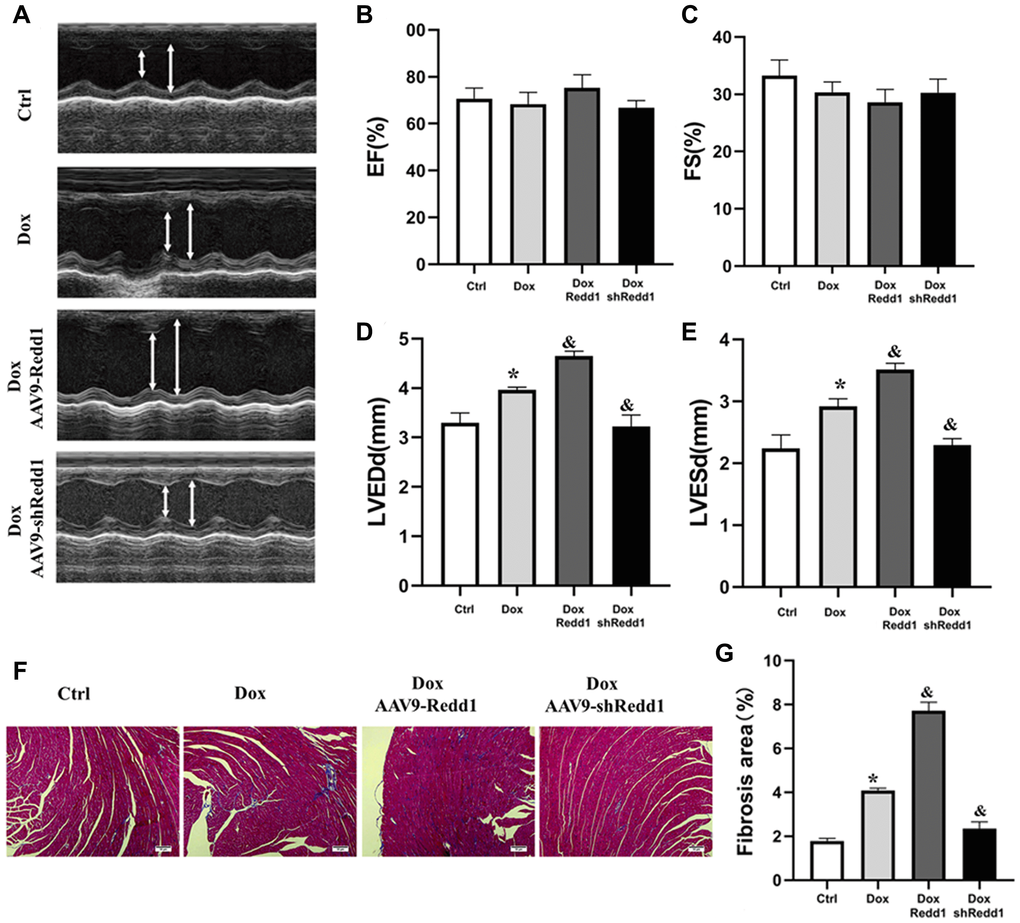 Modulation of Redd1 expression impacts Dox-induced cardiac alterations in vivo. (A) Representative echocardiography photographs depicting left ventricular function in the different groups of mice. (B–E) Analysis of the effects of Redd1 overexpression and knockdown on parameters of cardiac function in Dox-treated mice (n = 6–8 per group). (F) Effect of Redd1 overexpression and knockdown on cardiac fibrosis induced by Dox administration in vivo, as determined by Masson’s trichrome staining. (G) Quantitative analysis of Masson’s trichrome staining results (n = 6–8 per group). Data are mean ± SEM. *p &p 