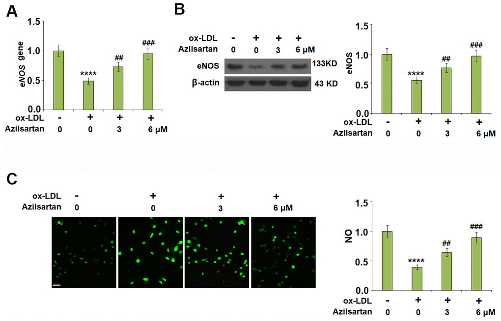 Azilsartan ameliorated ox-LDL-induced reduction of eNOS and nitric oxide (NO). Cells were stimulated with ox-LDL (100 μg/mL) in the presence or absence of Azilsartan (3, 6 μM) for 24 hours. (A) Gene expression of eNOS; (B) Protein of eNOS; (C) Production of NO. Scale bar, 200 μm (****, P
