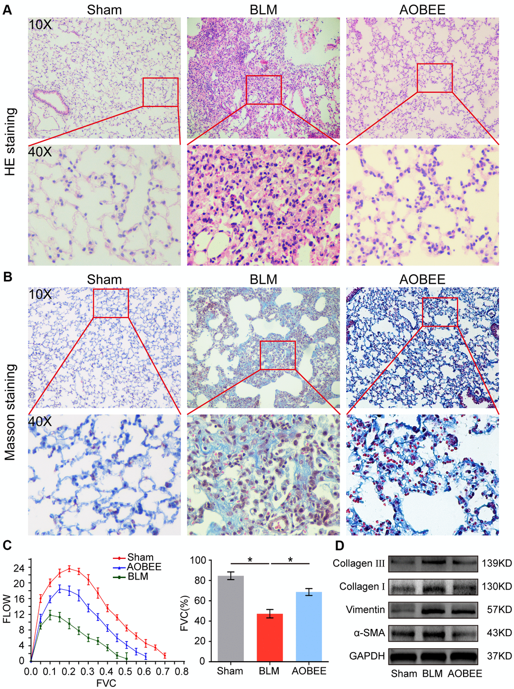 Anti-pulmonary fibrosis of AOBEE in vivo. (A) HE staining showed that AOBEE improved the alveolar structure of mice, such as more spacious alveolar space and thinner alveolar walls compared with those in the BLM group. (B) Masson staining showed that AOBEE treatment reduced the deposition of collagen fibers. (C) The Buxco PFT analysis system showed that AOBEE enhanced the pulmonary function of mice compared with those in the BLM group. (D) Western blot indicated that AOBEE inhibited α-SMA, vimentin, and collagen expression levels. Each bar represents the mean ± SD, n = 6, *p 