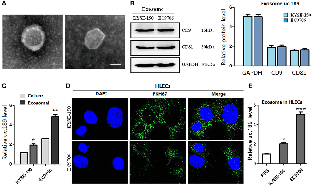 Exosomes of uc.189 can be secreted from ESCC cells and transferred to HLECs. (A) Photo of exosomes secreted from KYSE-150 and EC9706 was confirmed by transmission electron microscopy (Scale bar, 50nm). (B) Positive markers (CD9 and CD81) of KYSE-150 and EC9706-secreted exosomes were detected by western blot. (C) Uc.189 levels in ESCC cells and paired exosomes were detected by qRT-PCR. (D) HLECs pre-treated with PKH67-labeled exosomes for 48 hours were stained with DAPI (blue) for confocal microscopy analysis. Scale bar, 20 μm. (E) Uc.189 relative levels in HLECs pre-treated exosomes for 24 hours were detected by qRT-PCR. Error bars represent the mean ± SD of three independent experiments. *P **P ***P 