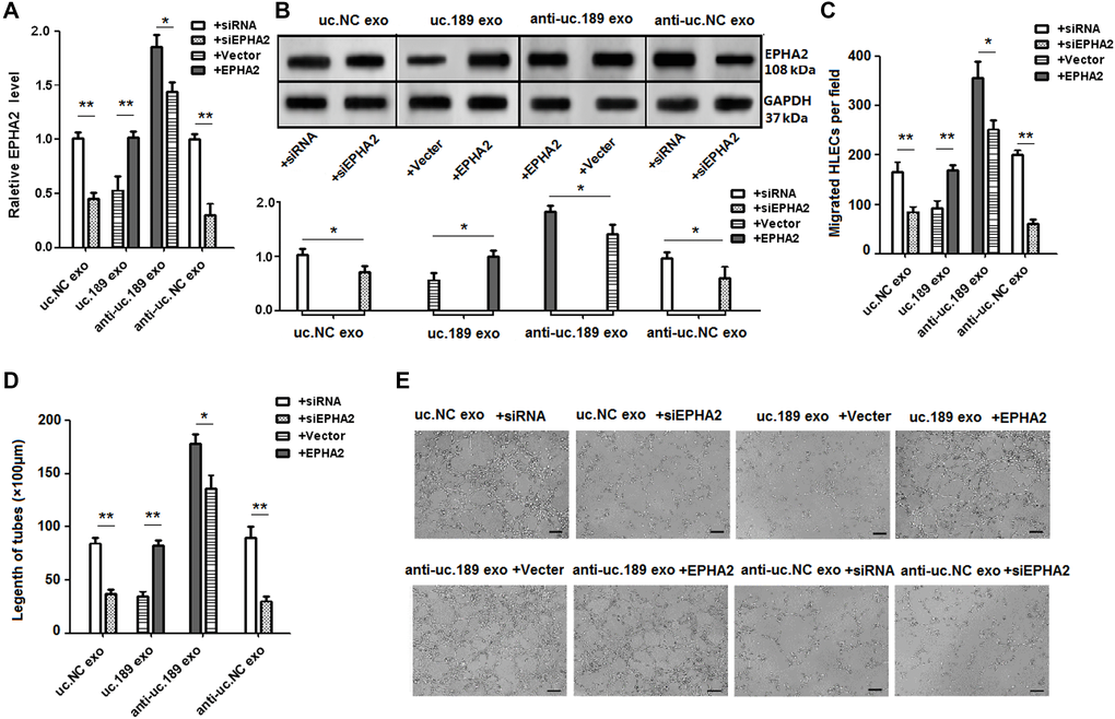 Rescue assays detected the effects of EPHA2 regulated by uc.189 in lymphangiogenesis. (A–B) RNA and protein levels of EPHA2 were detected respectively by qRT-PCR and western blot in HLECs with relative exosomes in the presence of EPHA2 overexpression or vector control and si-EPHA2 or siRNA control. (C–E) Overexpression of EPHA2 rescued the biologic effects via exosomal uc.189-induced, whereas knockdown of EPHA2 simulated the effects associated with exosomal uc.189 through cell migration and tube formation assays in HLECs. Error bars represent the mean ± SD of three independent experiments. *P **P ***P 