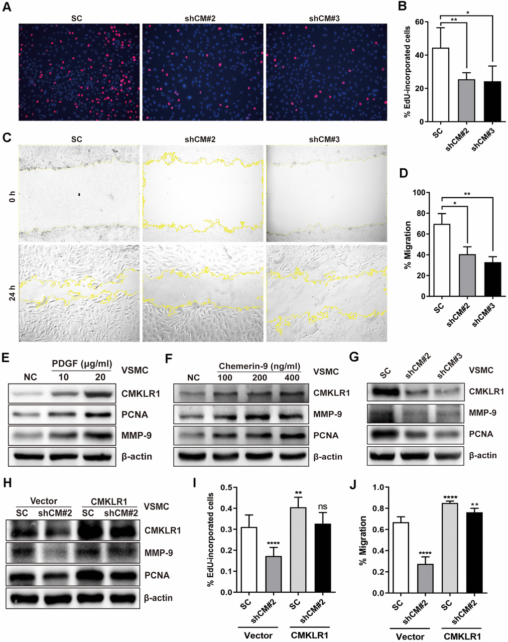 Downregulation of CMKLR1 inhibit VSMCs proliferation and migration. (A, B) Percentage of 5-Ethynyl-2'-deoxyuridine (EdU)-incorporated cells following the application of two independent shRNAs targeting CMKLR1 (scramble control, SC; shCMKLR1#2, shCM#2; shCMKLR1#3, shCM#3) to knock down CMKLR1 expression in mice vascular smooth muscle cells (VSMCs). *, ppC, D) Percentage of cell migration as determined by wound healing assay. *, ppE) Western blots showing CMKLR1, MMP-9 and PCNA expressions in cells treated with PDGF (48 h) for different durations. (F) Western blots showing CMKLR1, matrix metalloproteinase-9 (MMP-9) and proliferating cell nuclear antigen (PCNA) expression in cells treated with chemerin-9 (48 h) for different durations. (G) Western blots showing CMKLR1, MMP-9 and PCNA expressions with or without CMKLR1 knockdown. (H) Western blots showing CMKLR1, MMP-9 and PCNA expressions following the application of plasmids encoding CMKLR1 to overexpress CMKLR1 expression in VSMCs with or without CMKLR1 knockdown. (I) Analysis of the percentage EdU-incorporated cells with or without LCN2 depletion. ****, ppJ) Percentage of cell migration as determined by wound healing assay. ****, pp