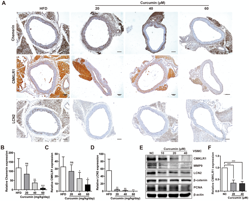 Curcumin inhibits CMKLR1 and LCN2 expression. (A) IHC analysis of chemerin / CMKLR1 and LCN2 expressions in aorta tissues of HFD ApoE-/- mice with or without curcumin treatment. Scale bar = 100 μm. Red arrows indicate plaques. (B–D) Chemerin / CMKLR1 and LCN2 expression score analysis data are presented as means ± SDs. n.s., no significant; *, pppE) Western blots showing CMKLR1, MMP-9, LCN2, β-catenin and PCNA expressions in cells treated with curcumin (48 h) for different durations. (F) mRNA expression of CMKLR1 with or without curcumin treatment (48 h) as determined by quantitative real-time PCR.