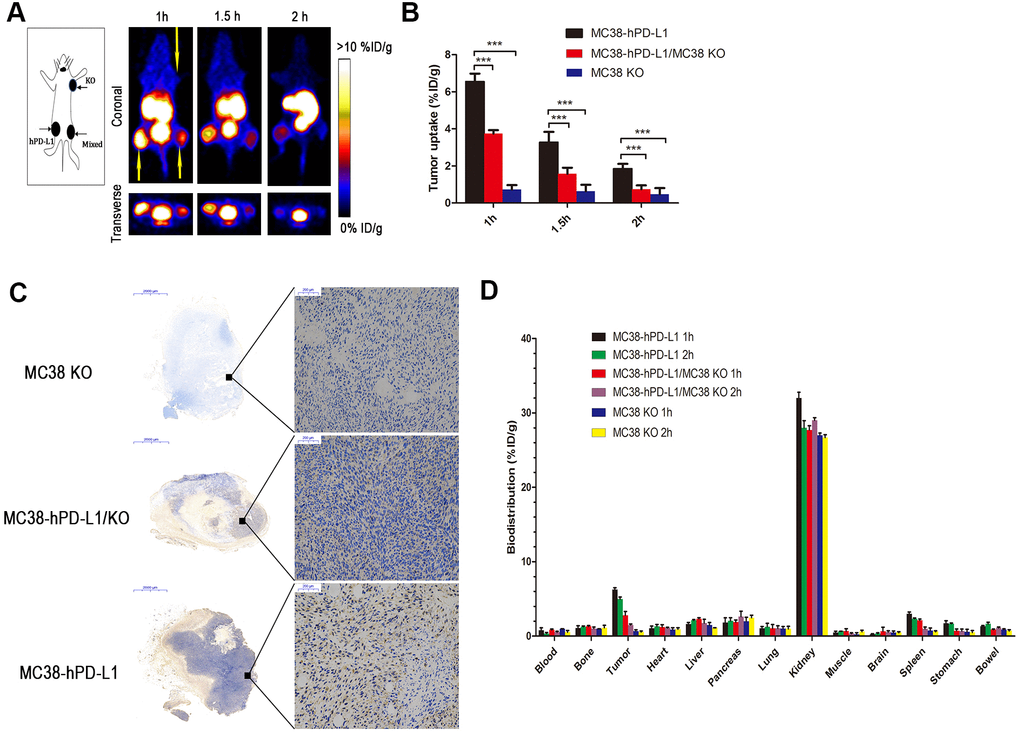 PET imaging of tumor-bearing models. (A) Static images at 1, 1.5, and 2h after injection of 2.5 MBq of 68Ga-NOTA-Nb109 (n=3, tumors indicated by the yellow arrow). (B) The uptake of 68Ga-NOTA-Nb109 in tumors according to quantification analysis of PET images. (C) PD-L1 immunohistochemical staining of tumors (n=5, scale bar =2 mm in the left column and 200 μm in right column). ***P D) Biodistribution of 68Ga-NOTA-Nb109 in major organs at 1 and 2 h (n=5).