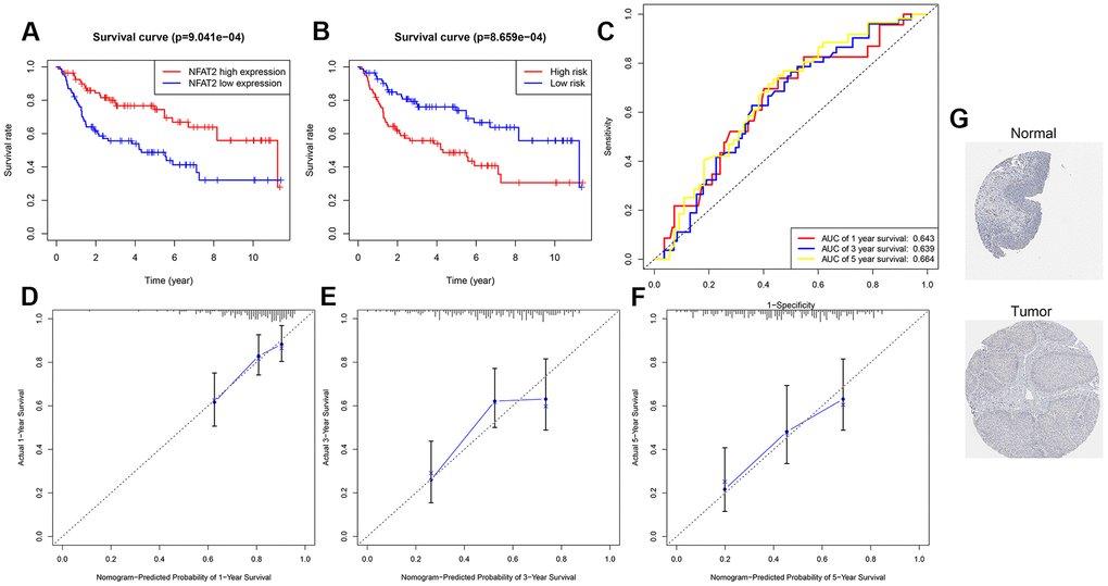 Validation of prognosis risk model. (A) Kaplan-Meier curves for OS time of patients with expression of NFAT2 in clinical study GSE100926. (B) Patients data from GSE100926 were divided by risk score into a high risk and a low risk groups. OS between two risk groups were analyzed and compared by Kaplan-Meier analysis. (C) 1-3-5 years ROC curves in GSE100926. The abscissa represents sensitivity, and the ordinate represents specificity. (D–F) The calibration curve for predicting 1-3-5 years OS for patients with BLCA. The Y-axis represents actual survival, as measured by K-M analysis, and the X-axis represents the nomogram-predicted survival (PG) The expression profiles of the NFAT2 in the normal bladder tissue and bladder specimens. Images were taken from the HPA.