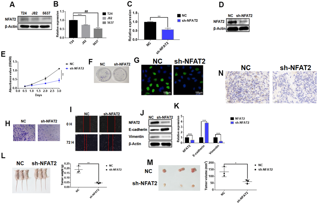 NFAT2 participates in the regulation of BLCA as an oncogene. (A) The expression of NFAT2 was verified by WB. (B) The expression of NFAT2 was verified by RT-PCR. (C) The knockdown efficiency was verified by RT-PCR. (D) The knockdown efficiency was verified by WB. (E) The cell viability was assessed by cell proliferation assay (see Materials and Methods). (F) Cell proliferation detected by colony formation assay. (G) Cell proliferation was measured by EdU incorporation assay. (H) Cell invasion measured by Transwell migration assay. (I) Cell migration evaluated by wounded cell monolayer closure assay. (J) Western Blot analysis of protein expression of NFAT2 and EMT-linked gene products. (K) Quantitative RT-PCR analysis of mRNA for NFAT2 and EMT-related genes. (L) Tumor weight from control and NFAT2 knockdown mouse tumor groups. (M) Tumor volume from control and NFAT2 knockdown mouse tumor groups. (N) Tumor cell proliferation evaluated by Ki-67 immunohistochemical staining. *PPPP