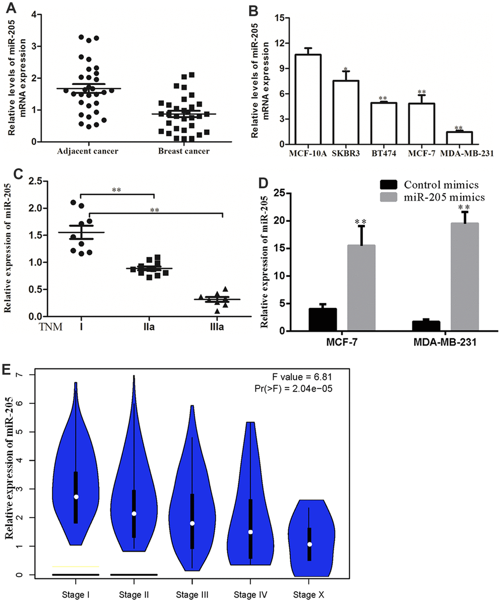 miR-205 expression was downregulated in breast cancer. (A) Expression levels of miR-205 in breast cancer tissues and adjacent normal breast tissues as analyzed by the qRT-PCR assay. (B) The expression of miR-205 in breast cancer cell lines and normal cell MCF10A. (C) The expression of miR-205 in breast cancer patients with TNM stages was significantly reduced. (D) Both MCF7 and MDA-MB-231 cells were transfected with control miRNA or miR-205 mimics, and the expression of miR-205 was confirmed by qRT-PCR. (E) The association between expression of miR-205 and clinical characteristics of patients with breast cancer. LinkedOmics database with TCGA data was used for this analysis. All experiments were carried out in triplicate. Data were expressed as mean ± standard deviation (SD).