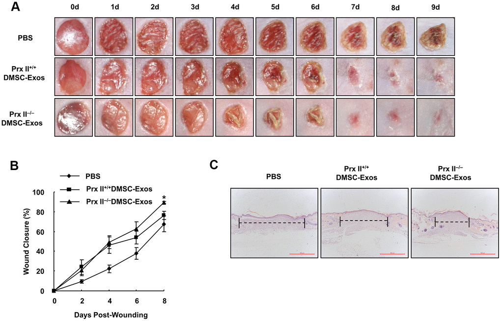 Prx II−/−DMSC-Exos promoted skin wound healing more effectively than Prx II+/+ DMSC-Exos. (A) Overall observed morphological changes in wound healing after treatment. (B) Wound-area changes during wound healing are shown. *p −/− DMSC-Exos. The data shown represent the mean ± SD (n = 6). (C) Histological images (H&E staining) of the wound. Wounds are indicated with dashed lines.