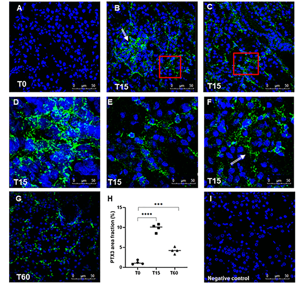 Analysis of PTX3 deposits in a swine model of I/R injury. Indirect immunofluorescence for PTX3 was performed on frozen pig kidney sections. A limited presence of PTX3 was observed in the biopsies at T0 (A). PTX3 deposits were observed after 15 min of reperfusion (B, C) at interstitial (E, zoomed image), peri-tubular (F, zoomed image) and glomerular (D) capillary levels. After 60 min the PTX3 deposits were still described at the level of peritubular capillaries (G). (I) Negative staining control for immunofluorescence was performed on cryosections with irrelevant primary antibodies for experimental conditions. Nuclei were highlighted with TO-PRO 3 in blue. Magnification 630X. (H) Quantification of PTX3 demonstrated a statistically significant increase after 15 min of reperfusion compared to basal biopsies. Results were expressed as % ± s.d. of positive area /high power field (hpf). *p