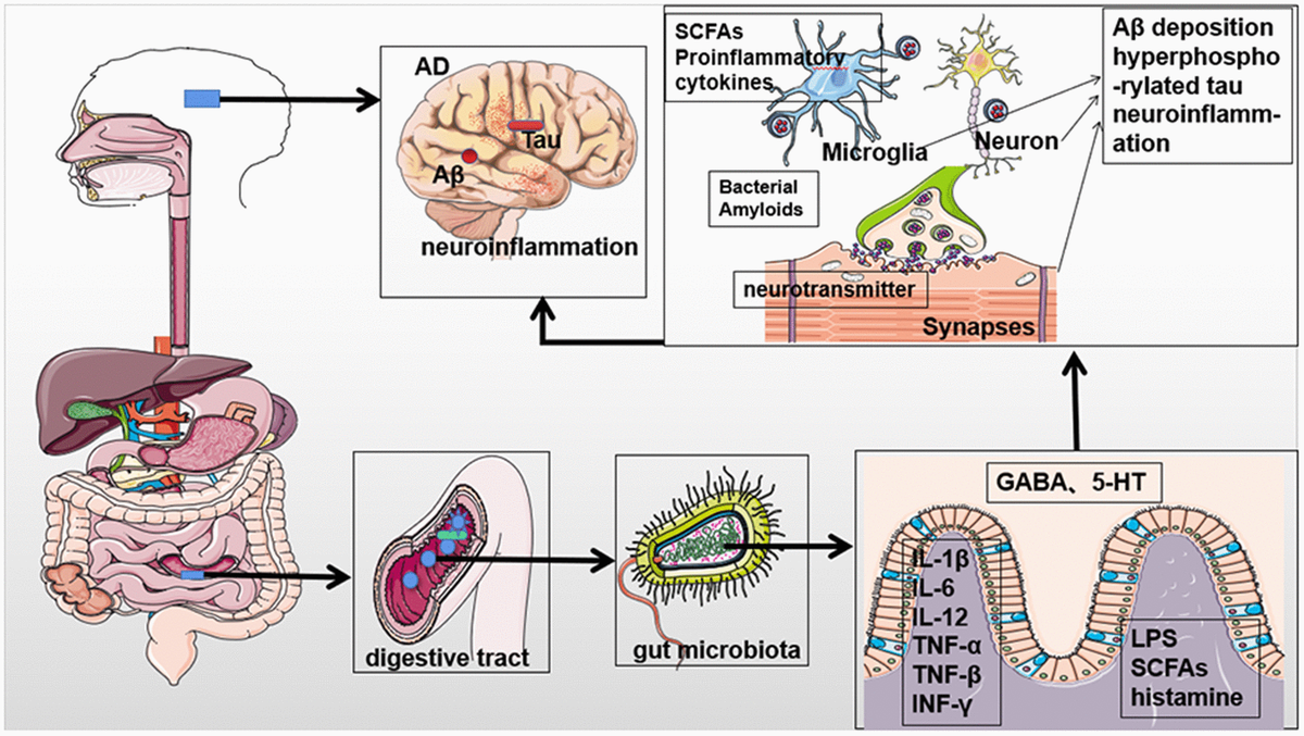 Gut microbial involvement in Alzheimer's disease pathogenesis Figure