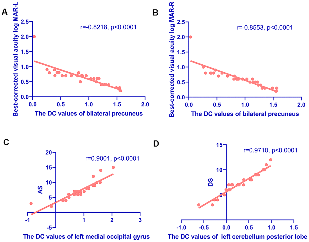 Correlations between the DC values of different regions and the clinical behaviors in HR group. (A, B) Correlations between the DC values of bilateral precuneus and best-corrected visual acuity. The DC values of bilateral precuneus were positively correlated with the values of BCVA-L(LogMAR) (r=-0.8218, pA) and BCVA-R (LogMAR) (r=-0.8553, pB). (C, D) Correlations between the DC values of specific cerebral regions and the Hospital Anxiety and Depression Scale. The DC values of the left middle occipital gyrus were positively correlated with AS (r=0.9001, pC); and the DC values of the left cerebellum posterior lobe were positively correlated with the DS (r=0.9710, pD). Abbreviations: DC, degree centrality; AS, anxiety scores; DS, depression scores.