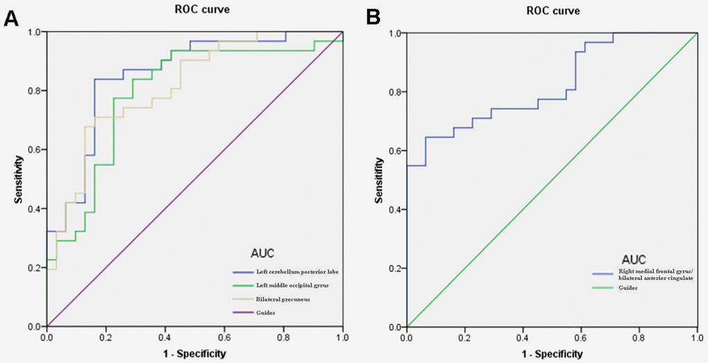 ROC curve analysis of the mean DC values for altered brain regions. Notes: (A) The area under the ROC curve were 0.855, (pB) The area under the ROC curve was 0.822 (p