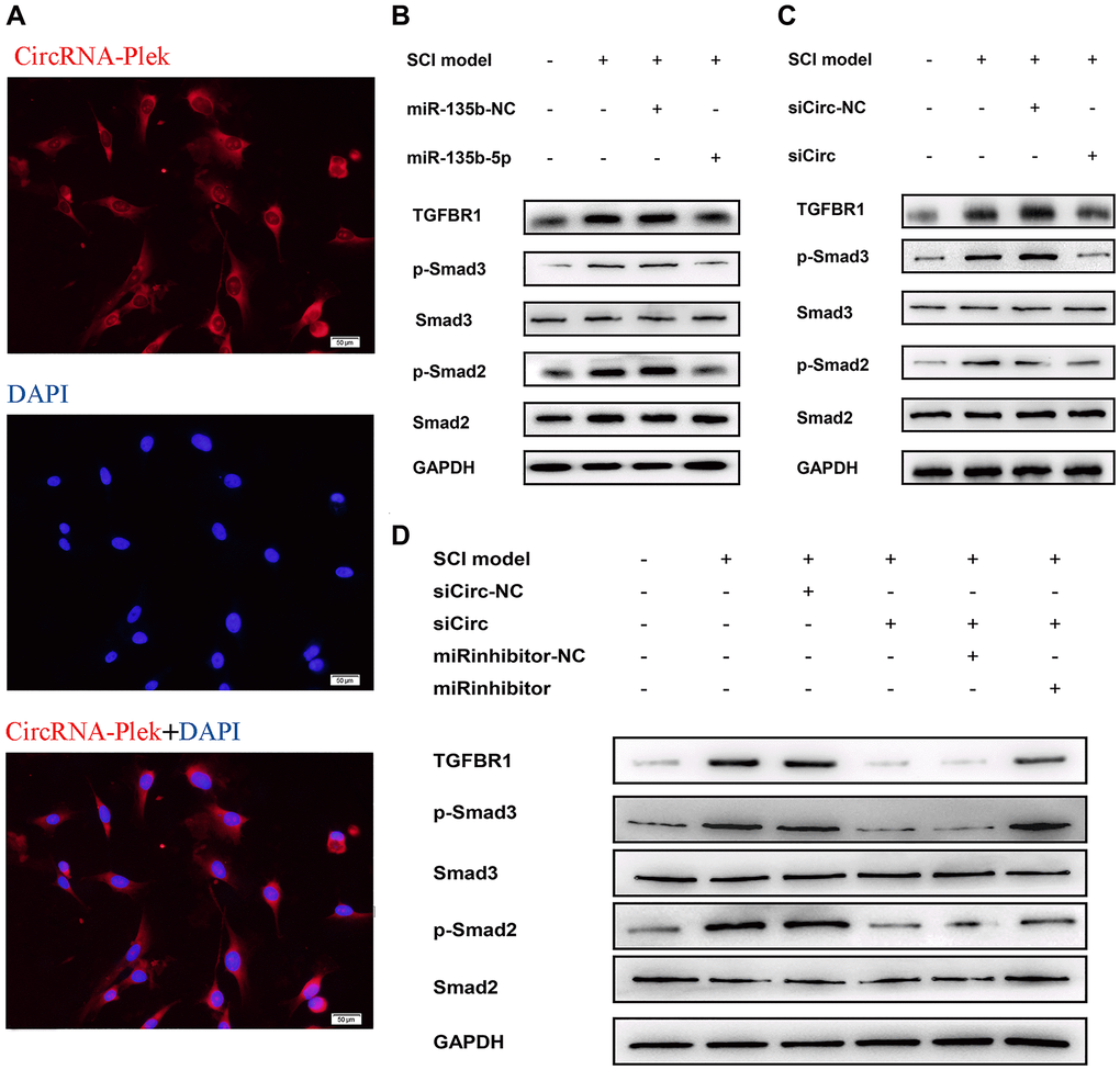 CircPlek/miR-135b-5p/TGF-βR1 axis affects the activation of TGF-β/Smad signaling pathway. (A) Fluorescence assays were performed to detect the location of CircPlek in spinal fibroblasts. Red represents CircPlek staining and blue represents nuclear DNA staining by DAPI. (B–C) Western blot analysis of the protein levels of Smad2, Smad3, p-Smad2, and p-Smad3 in spinal fibroblasts transfected with miR-135b-5p mimics (B) or siCircPlek (C). (D) After co-transfection of spinal fibroblasts with siCircPlek and an miR-135b-5p inhibitor with or without SCI, Smad2, Smad3, p-Smad2, and p-Smad3 protein levels were measured using western blotting.