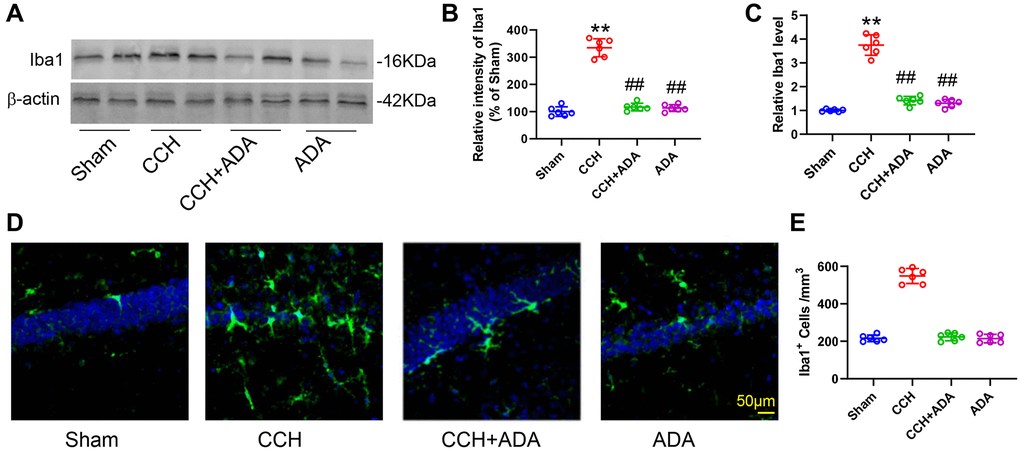 ADA alleviated microglial activation in CCH rats. (A) Representative blots of Iba1 in the different groups. β-Actin was used as loading control. (B) Quantification of the optical intensity of Iba1 in (A). (C) mRNA expression of Iba1 in the different groups. (D) Representative immunofluorescence images of Iba1 in the different groups. (E) Quantification of Iba1+ cells in (D). All values are expressed as the mean ± SEM (n = 6). **p ##p 