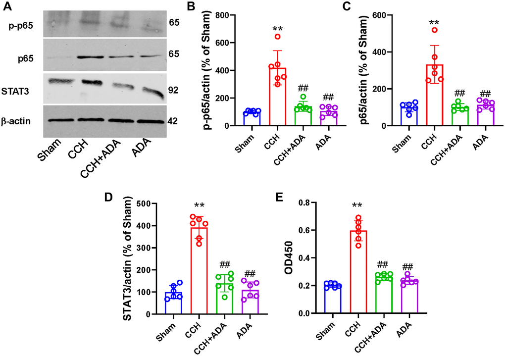 ADA inhibited NF-κB signaling in CCH rats. (A) Representative blots for p-p65, p65 and STAT3 in the different groups are shown. β-Actin was used as loading control. (B–D) Quantification of the optical intensity of p-p65 (B), p65 (C) and STAT3 (D). (E) NF-κB activity was evaluated by ELISA kits. All values are expressed as the mean ± SEM (n = 6). **p ##p 