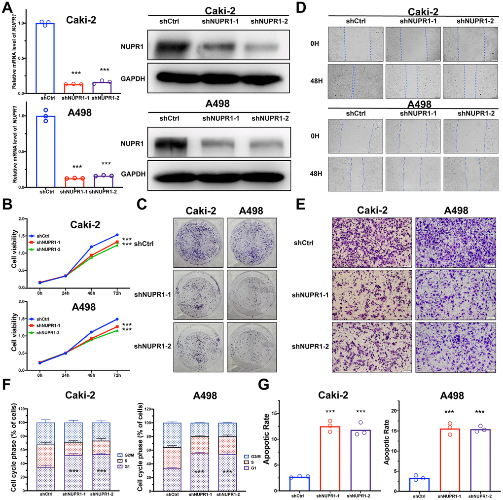 NUPR1 facilitated tumorigenesis of ccRCC in vitro. (A) Verification of NUPR1 mRNA and protein knockdown in ccRCC cell lines. (B) Cell growth curves of CCK-8 assay for ccRCC cell lines with NUPR1 silencing. (C) Colony formation assay for ccRCC cells with NUPR1 depletion. (D) The wound-healing assay of NUPR1 silencing on the migration of ccRCC cells. (E) Transwell experiment analysis of the effect of NUPR1 depletion on migratory and invasive abilities of ccRCC cells. (F) Effects of NUPR1 silencing on cell cycle regulation using flow cytometry. (G) Apoptosis assay of silencing NUPR1 in ccRCC by flow cytometry. (*p p p 