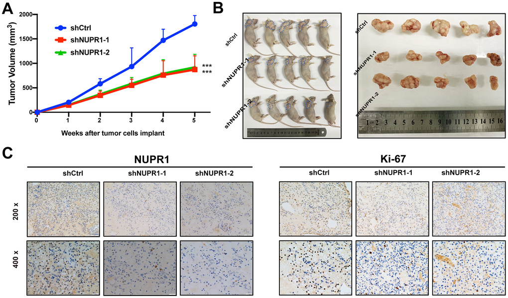 NUPR1 promoted aggressive abilities of ccRCC in vivo. (A) Growth curves of subcutaneous xenografts in nude mice (n=5). (B) Photographs of nude mice and xenografts. (C) NUPR1 and Ki-67 expression were detected by IHC in xenografts sections. (*p p p 